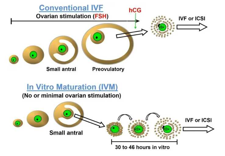 代生-自然周期移植囊胚步骤(自然周期移植囊胚)